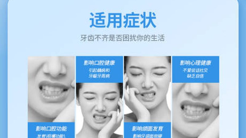 根管治疗牙套加盟，你需要了解这些**