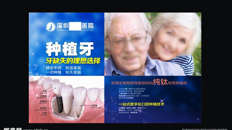 成人隐形牙套，如何选择合适厂家直销？**